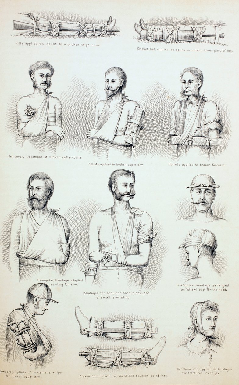 अस्थाई उपचार अस्थाई उपचार, c.1890 द्वारा अंग्रेजी स्कूल