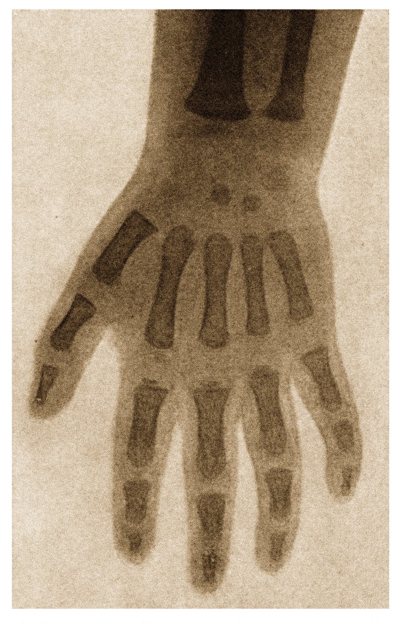 एक चिल्ड हाथ का X रे c.1890 द्वारा जर्मन स्कूल