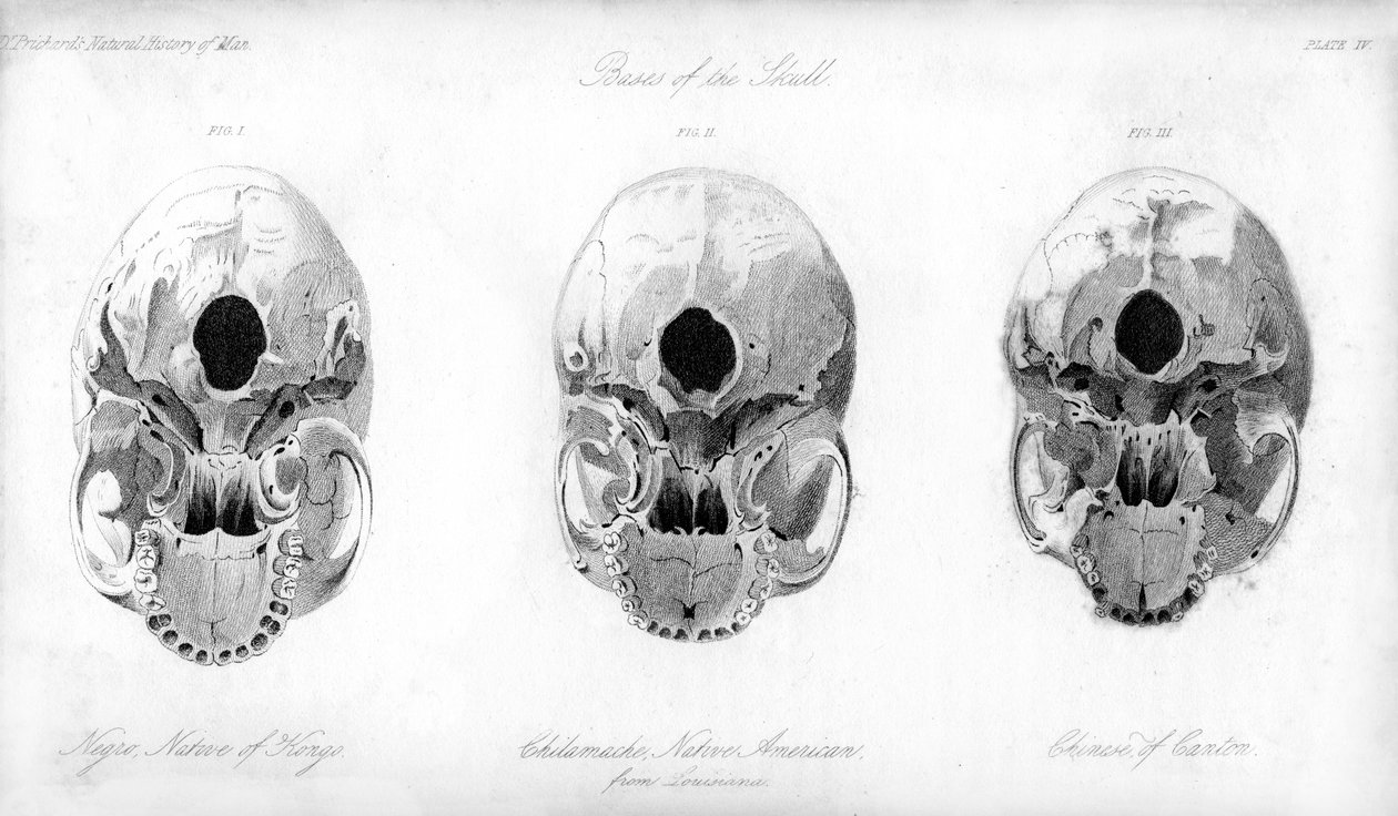 खोपड़ी का आधार, 1848 द्वारा अज्ञात